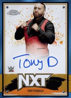 Tony D'Angelo